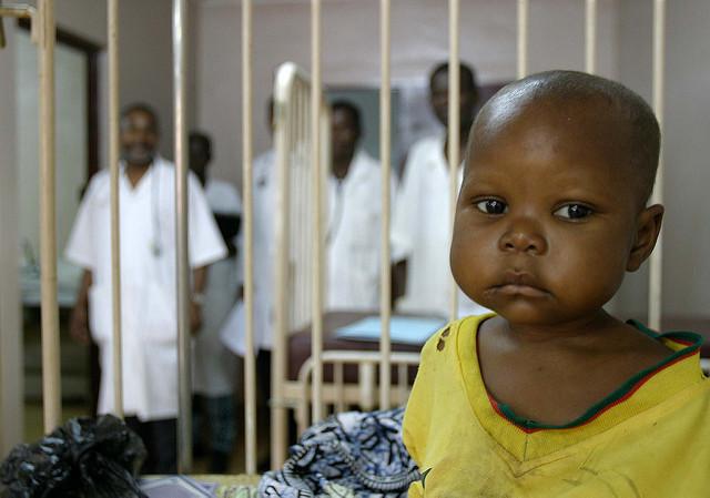 Kwashiorkor: sintomas, causas, fisiopatologia e tratamento 3