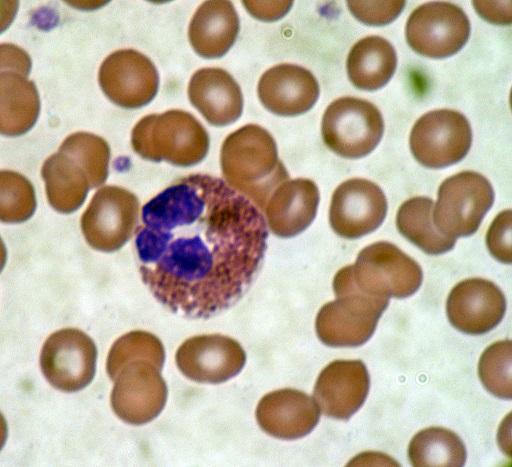 Esfregaço bacteriano: características e preparação 3