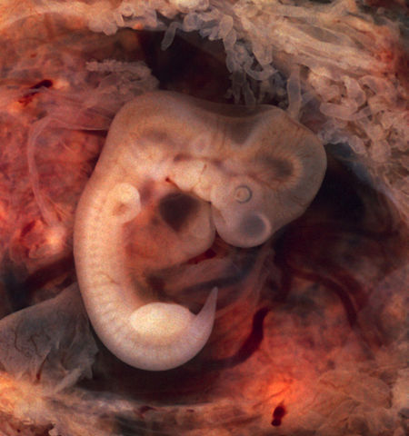 Sinal de Piskacek: o que é, anatomia, gravidez e gravidez 1