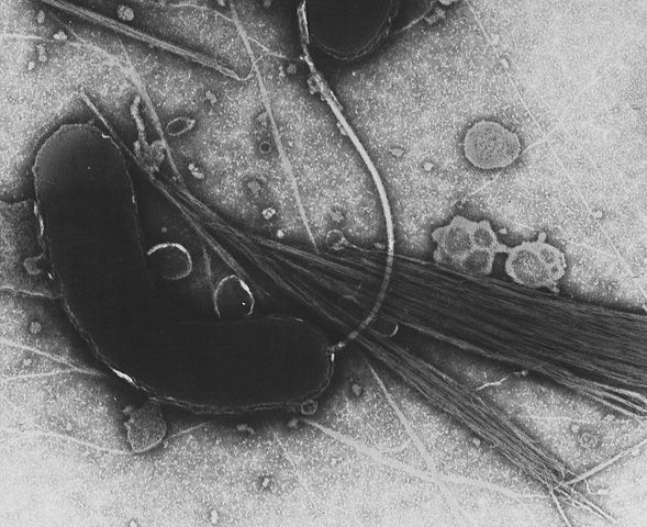 Vibrio cholerae: características, morfologia, habitat 1