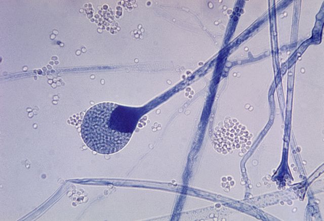 Zygomycota: características, sistemática, alimentar, habitat 23