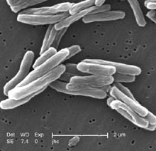 Bactérias aeróbicas: características, exemplos, culturas, doenças 1