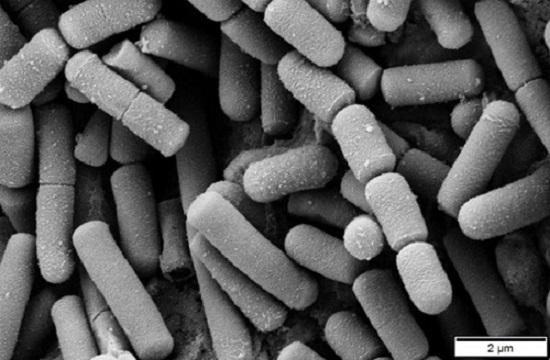 Bacillus cereus: características, morfologia, habitat 1