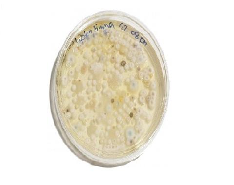 Agar Papa dextrose: fundação, preparação e uso 3