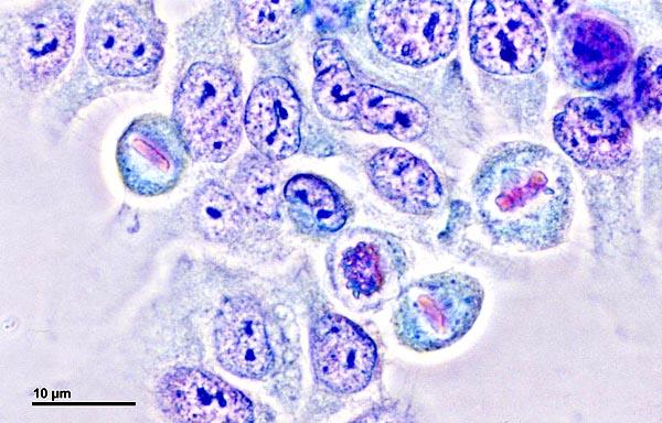 Células HeLa: história, características, ciclo celular e usos 1