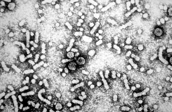 Hepadnavírus: características, morfologia, tratamento 1
