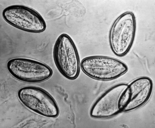 pinworms morfológia partneri fertőzés genitális szemölcsökkel