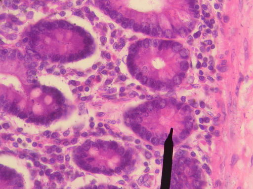 Células de Paneth: características, funções, histologia 1