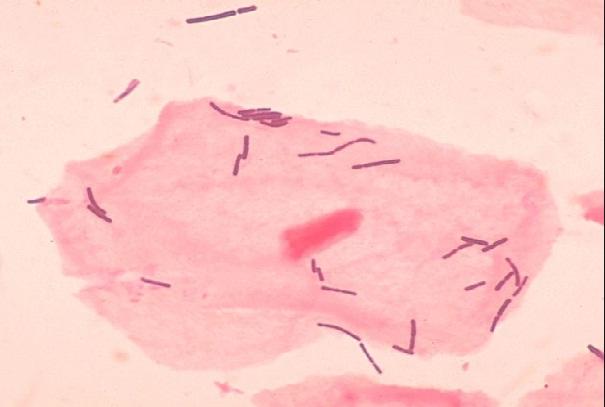 Lactobacillus acidophilus: características, taxonomia, morfologia 1