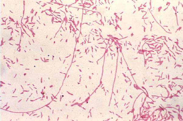 Legionella pneumophila: características, morfologia, patologia 1