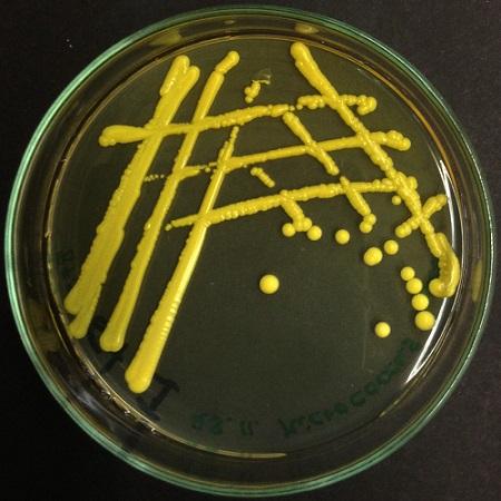 Micrococcus luteus: características, morfologia, doenças 3