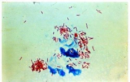 Mycobacterium leprae: características, morfologia, cultura 1