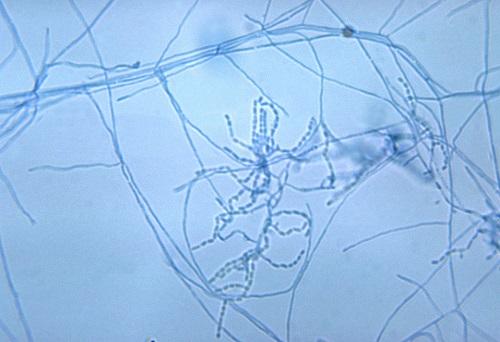 Nocardia: características, morfologia, cultura, patogênese 1