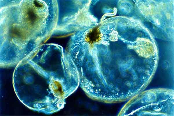 Plâncton: características, tipos, alimentação e reprodução 4