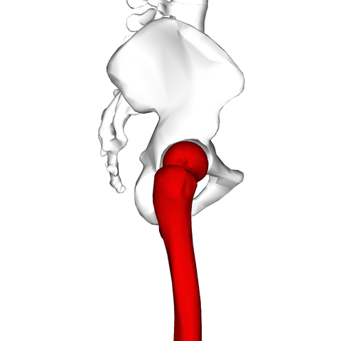 Osteooma Osteoma: Sintomas, Causas e Tratamento 41
