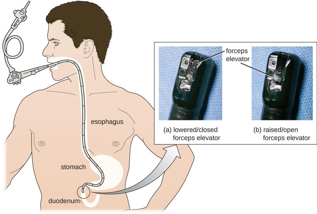 Panendoscopia: Para que serve, Indicações 1