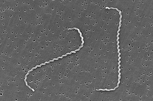 Leptospira interrogans: características, morfologia 1