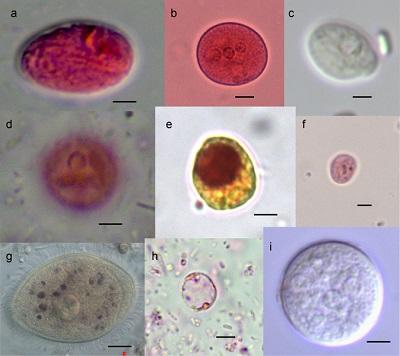 Chilomastix mesnili: características, morfologia, ciclo biológico 1