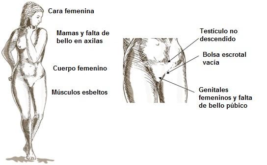 Síndrome de Morris: sintomas, causas, tratamentos 1