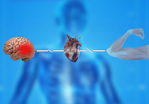 Choque neurogênico: sintomas, causas, tratamento 15