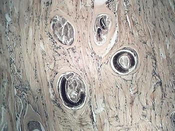 Trichinella spiralis: características, morfologia, ciclo biológico 4
