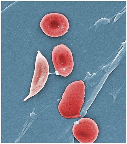 Eritrócitos (glóbulos vermelhos): características, funções 4
