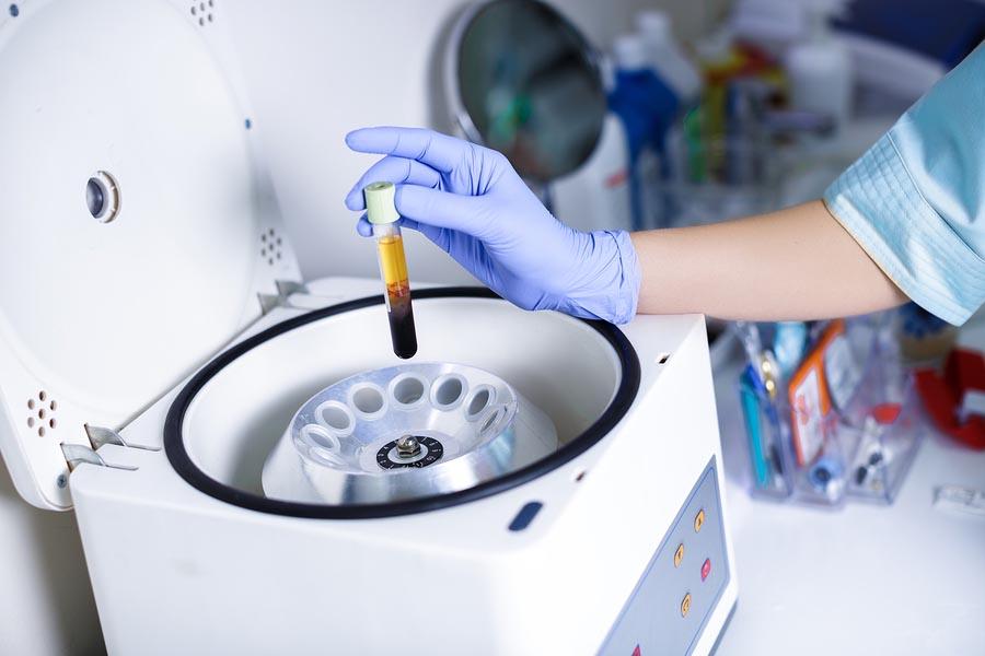 Separabilidade química: conceitos e exemplos 1