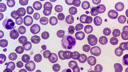 Eritrócitos (glóbulos vermelhos): características e funcionamento 1