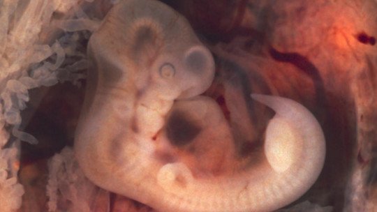 As três fases do desenvolvimento intra-uterino ou pré-natal: do zigoto ao  feto 
