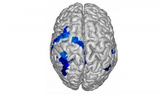 Hemisfério cerebral esquerdo: partes, características e funções 1