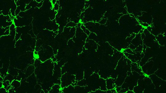 Microglia: principais funções e doenças associadas 1