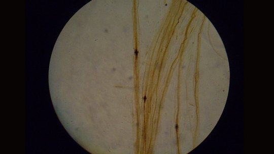 Nódulos de Ranvier: o que são e como servem os neurônios 1
