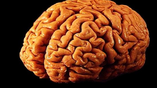 Psicoterapia produz alterações no cérebro 1