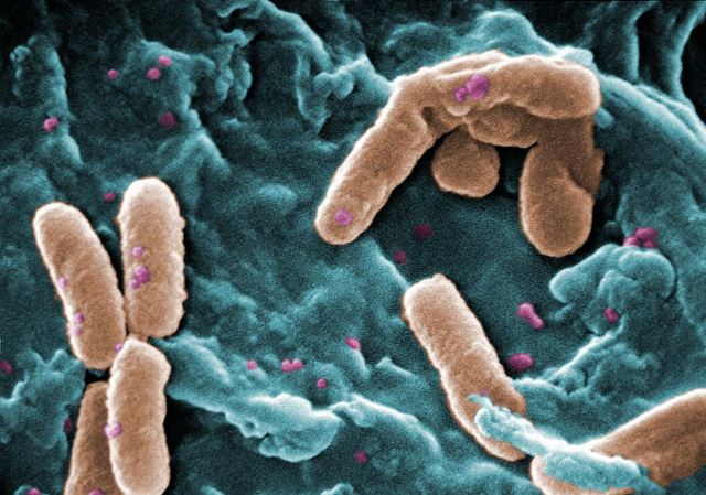 Pseudomonas aeruginosa: características, morfologia, sintomas 1