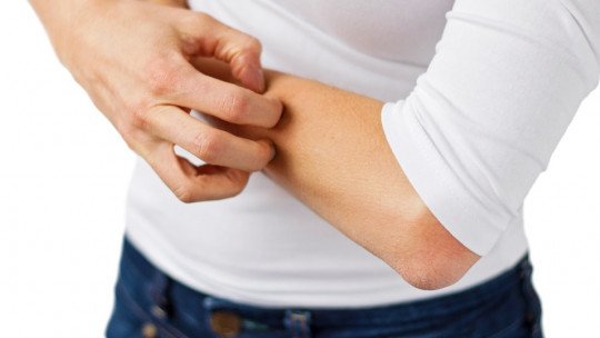 Síndrome de Morgellons: sintomas, tratamento e teorias que o explicam 1