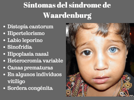 Síndrome de Waardenburg: sintomas, causas, tratamento 3