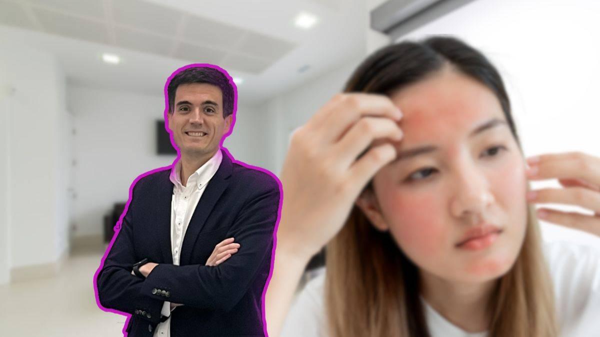 Dermatite periorale e impatto emotivo