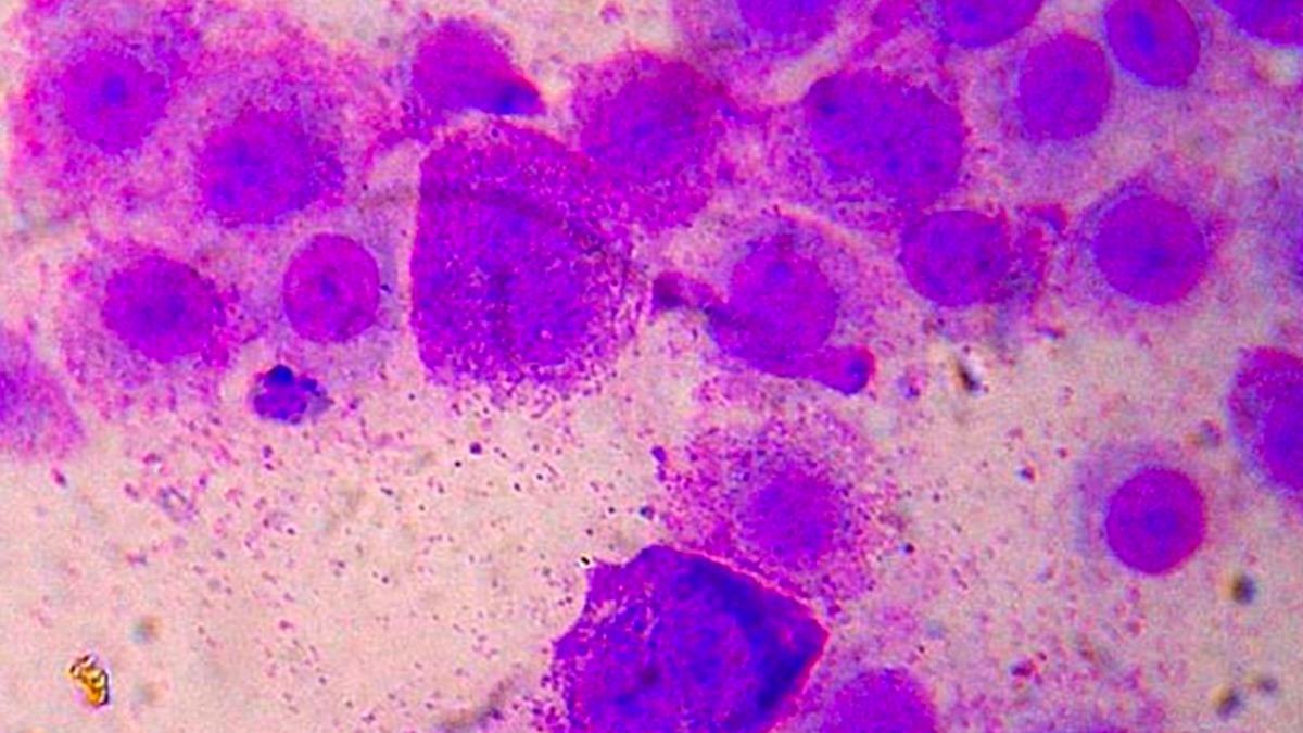 mastocitos em tecido conjuntivo