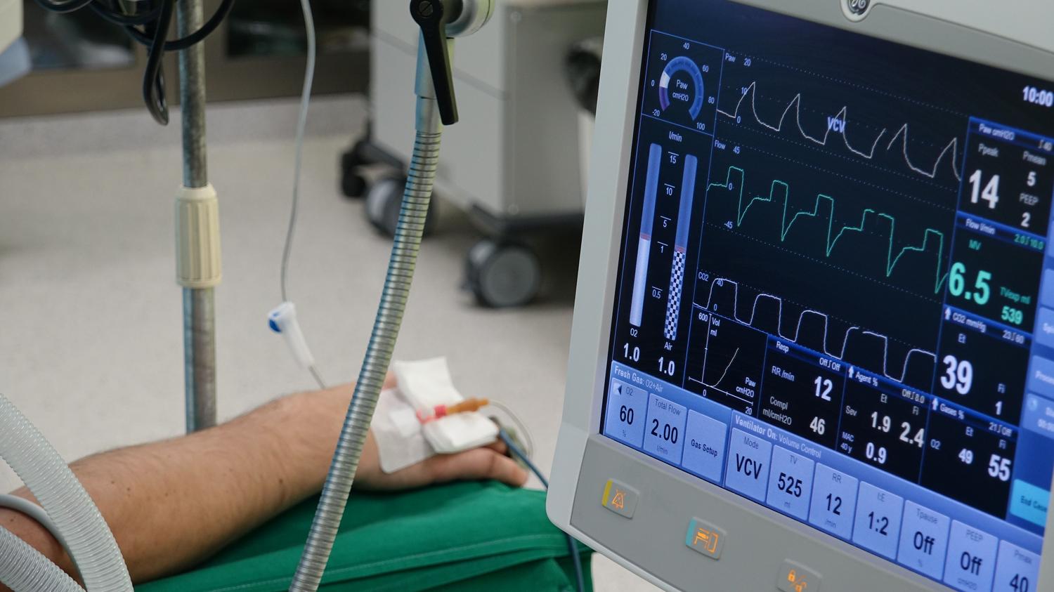 Detalle de la mano de un paciente y monitor de ventilación mecánica en cuidados intensivos