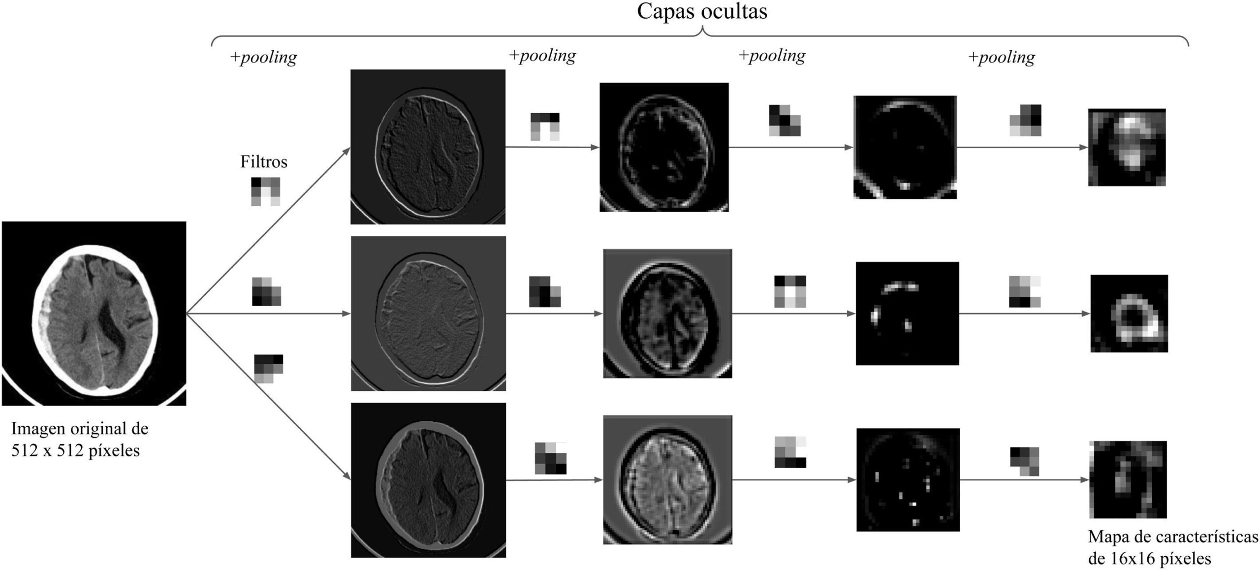 Inteligência Artificial em Radiologia