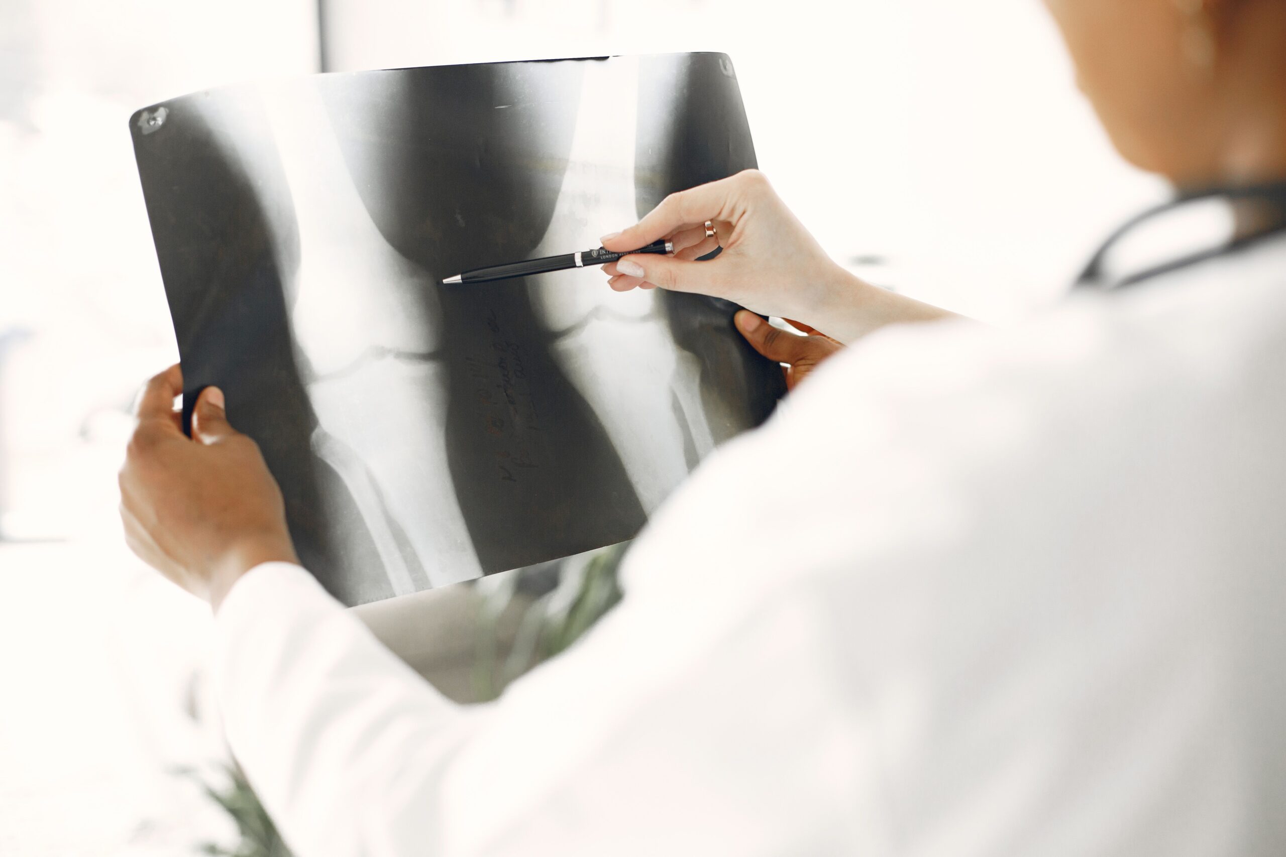 Un médico profesional analizando una radiografía de la zona pélvica para diagnosticar la densidad ósea y la osteoporosis.