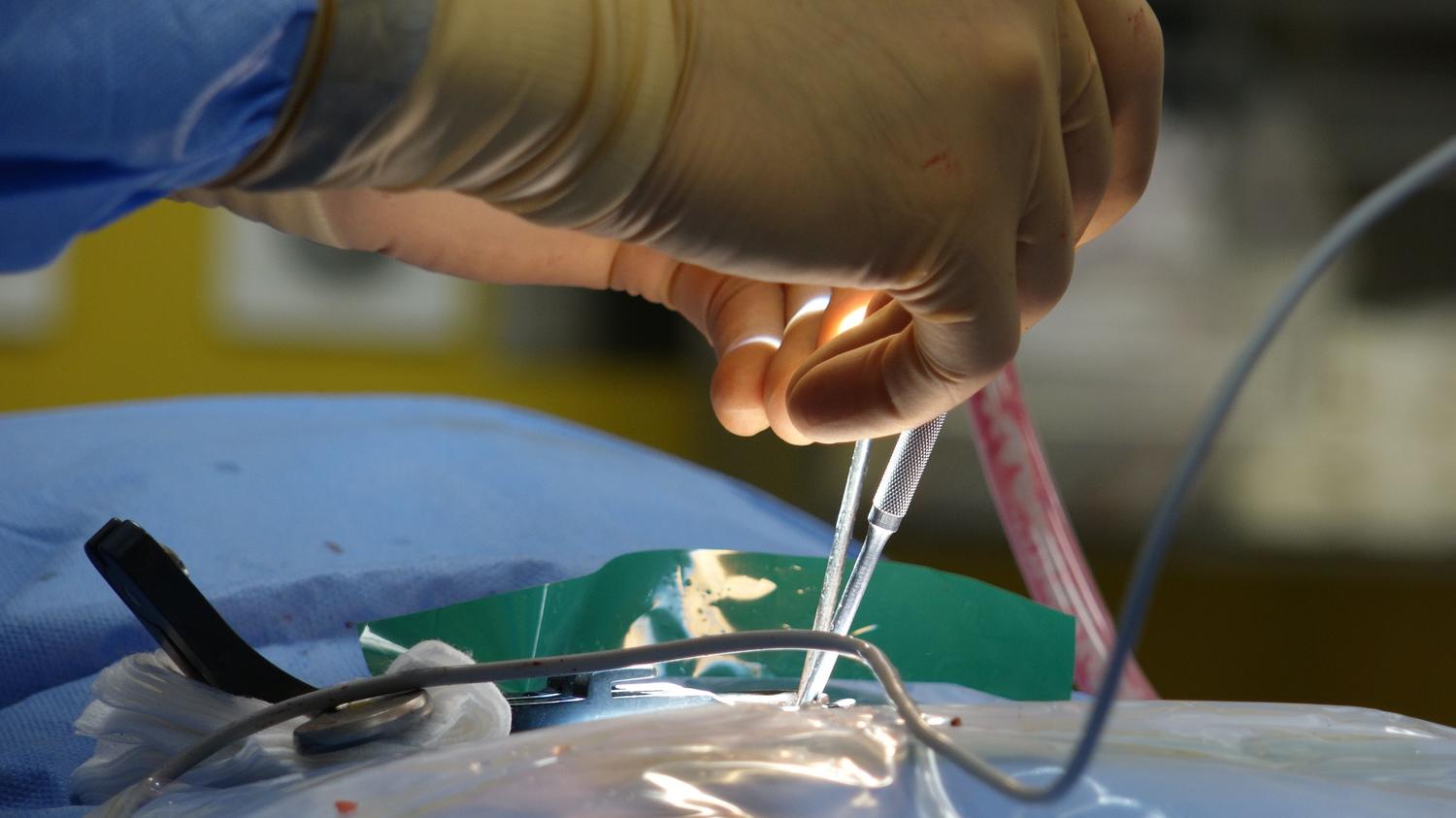 Primer plano de las manos de un cirujano realizando un procedimiento intrincado, representando la precisión técnica y el arte de la ejecución quirúrgica.