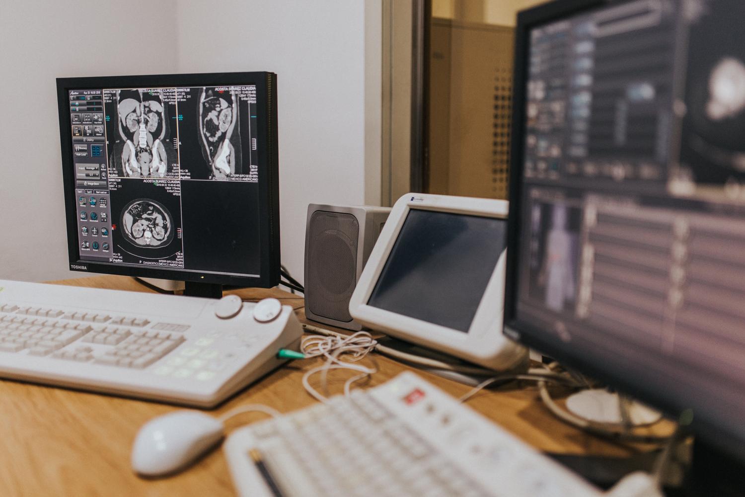 Estación de trabajo de radiología con imágenes de tomografía computarizada para análisis de radiómica en oncología
