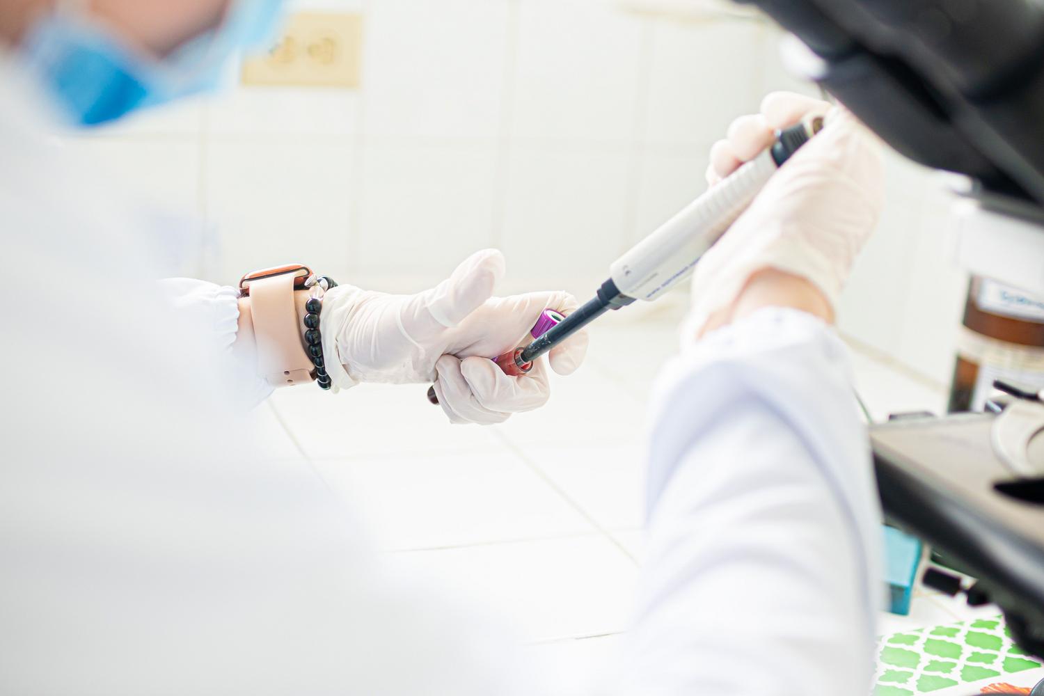 Profesional médico utilizando una pipeta en un laboratorio, representando la investigación científica en inmunoterapia