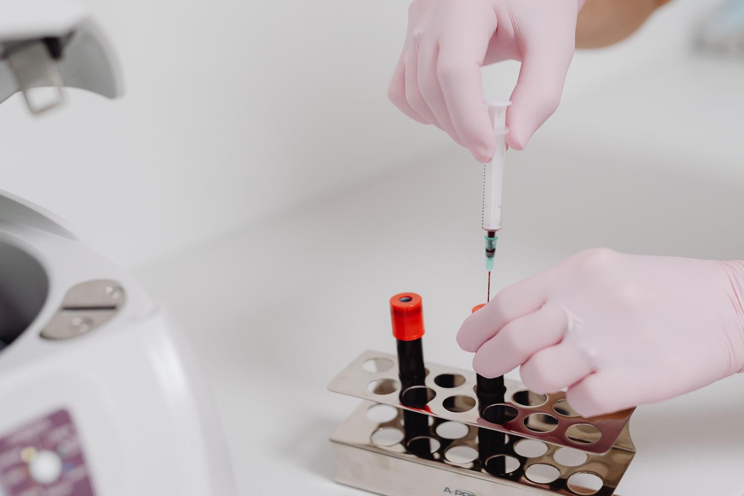 Técnico de laboratorio analizando muestras de sangre para el monitoreo constante del paciente en tratamiento oncológico