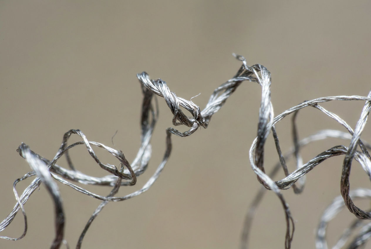 Detalle macro de cabello quebradizo y retorcido con tono metálico, síntoma característico de la enfermedad de Menkes.