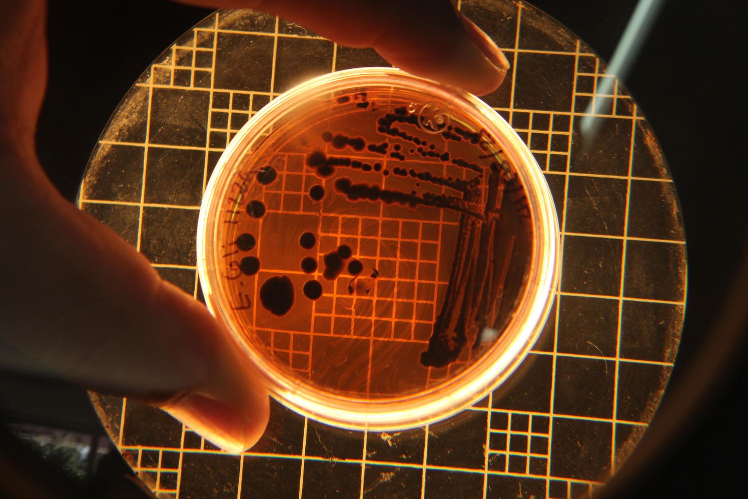 Colonias bacterianas en una placa de Petri observadas bajo microscopio, ilustrando el concepto de transistores biológicos y circuitos vivos.