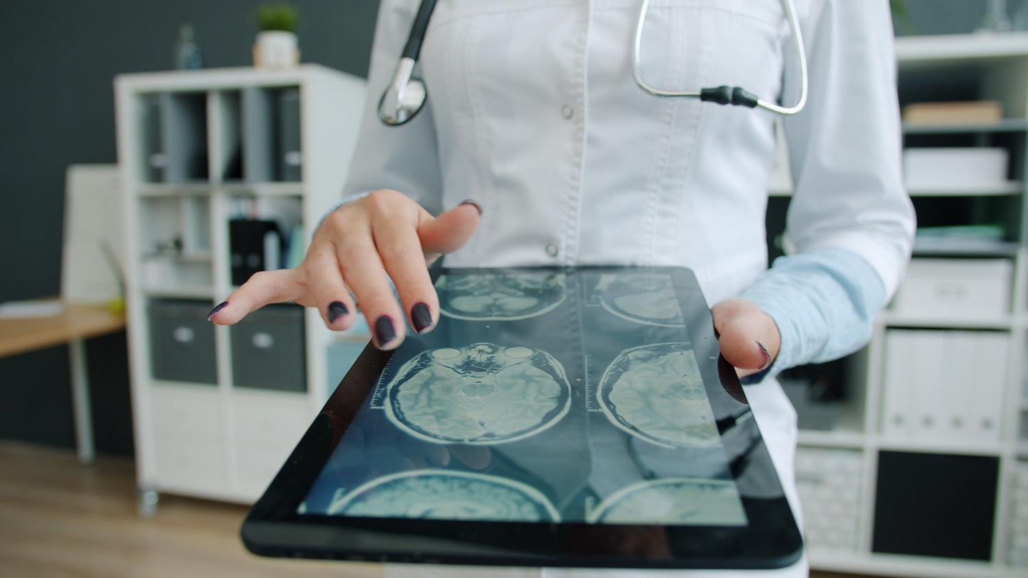 Médico analizando escaneos cerebrales digitales en una tablet, representando el uso de IA en el diagnóstico de ictus.