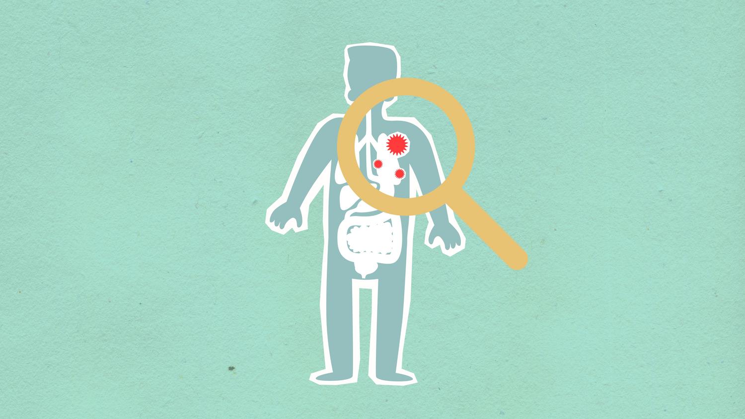 Imagen conceptual de un hombre bajo una lupa con virus propagándose, simbolizando el estudio científico de la inmunología y la detección de patógenos.