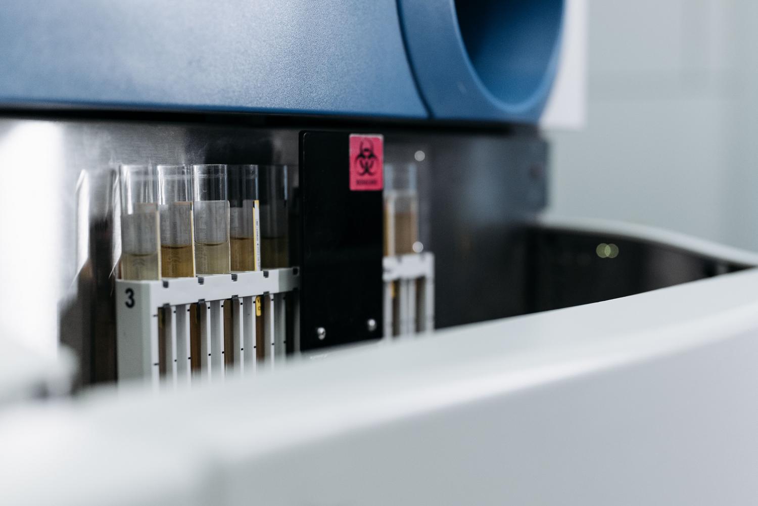 Tubos de ensayo en un laboratorio de investigación médica para el estudio de marcadores metabólicos